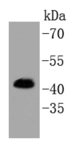 ERK1/2, p Thr202, p Tyr204, p Thr185, p Tyr187 Antibody (SC58-01), Novus